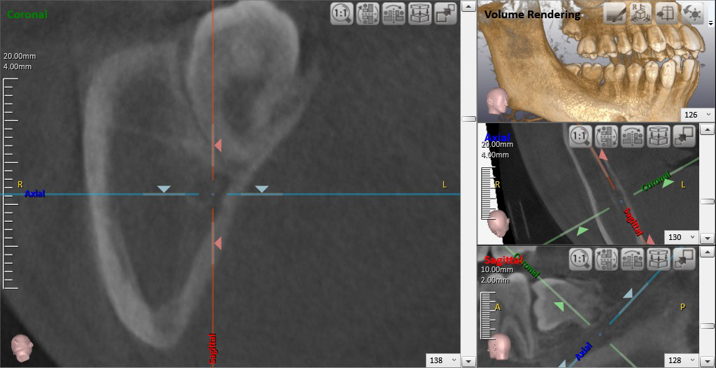 高崎　歯科用CT検査