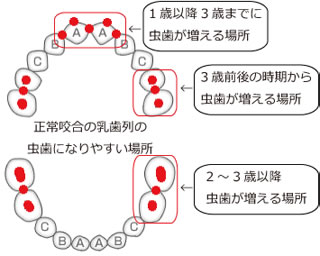 歯科健診　高崎