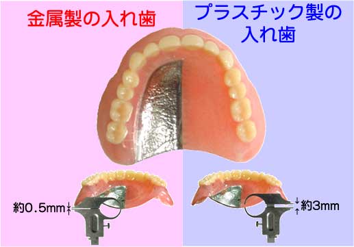 高崎　違和感の少ない入れ歯