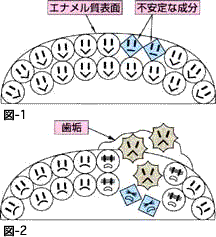 フッ素　高崎